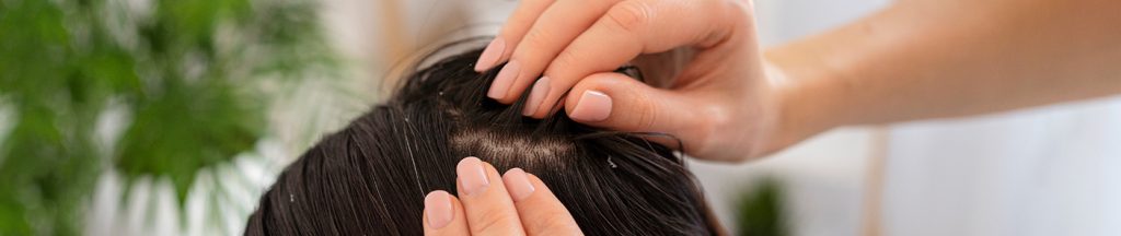 Healthy Scalp Care