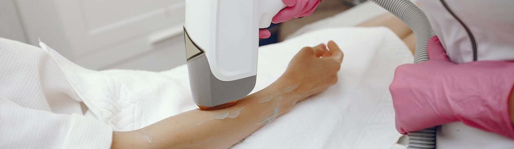 laser hair removal aftercare